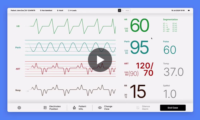 ECG Monitor design