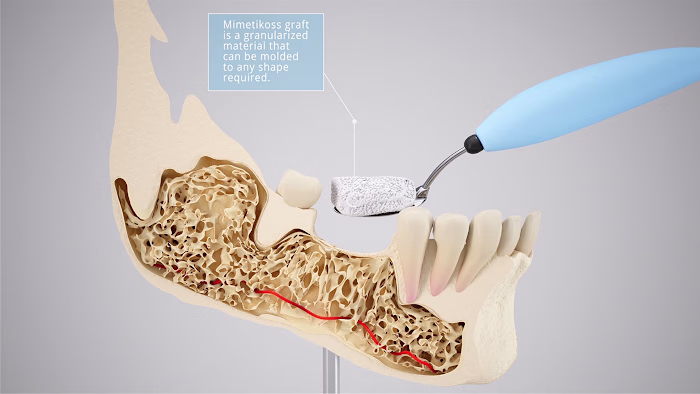 3D animation for Mimetikoss