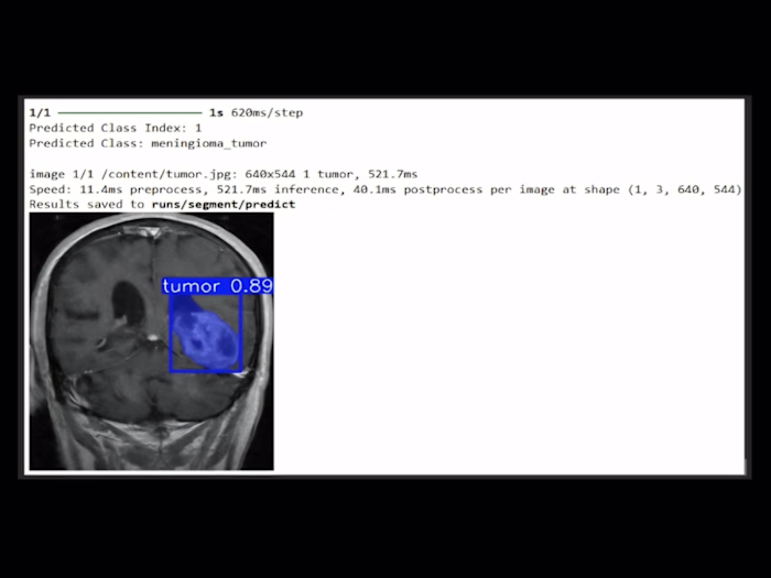 Brain Tumor Classification & Segmentation