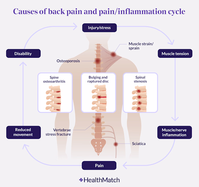 Writing and Researching: When Painkillers Make Back Pain Worse
