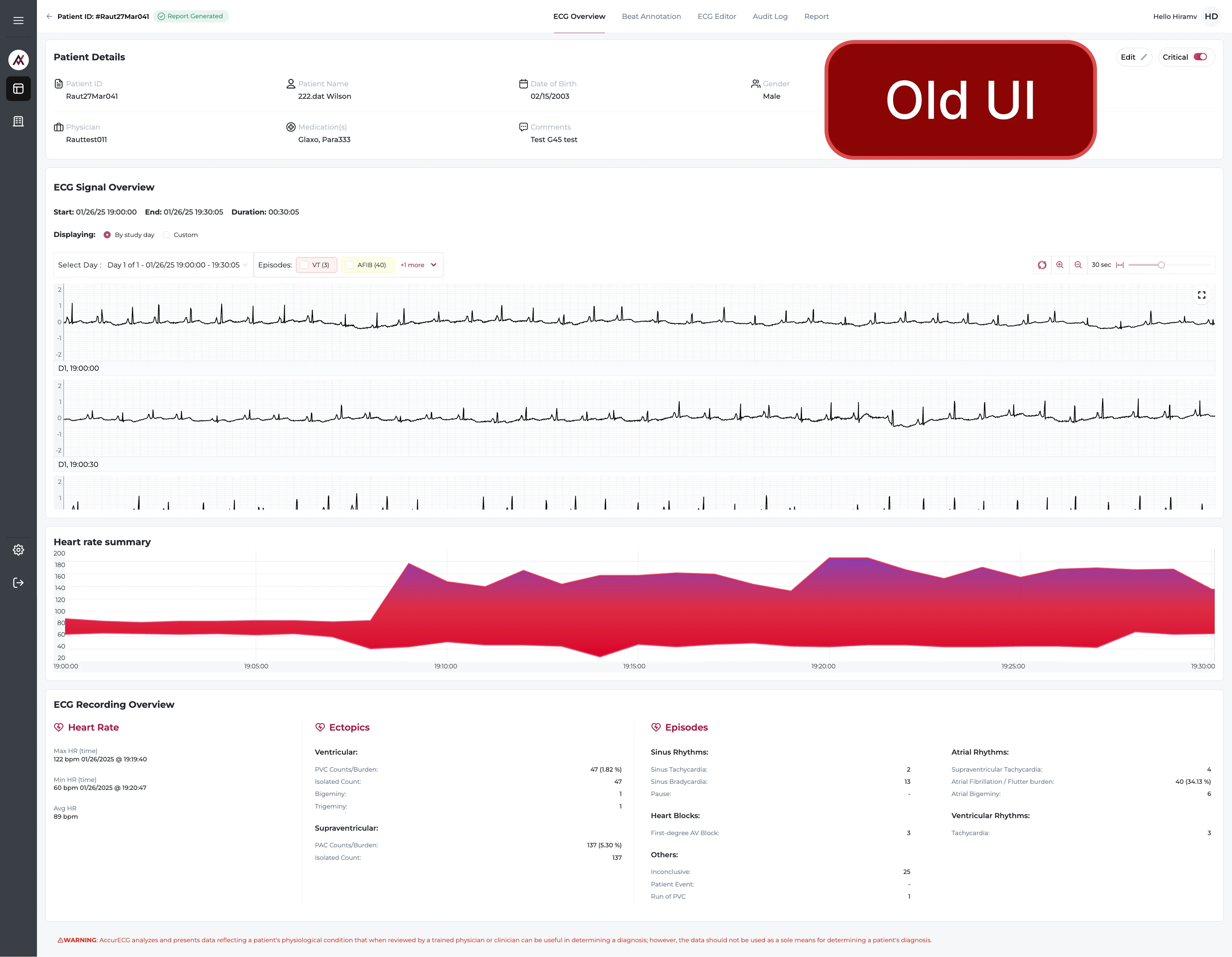 ECG Overview - Old Screen