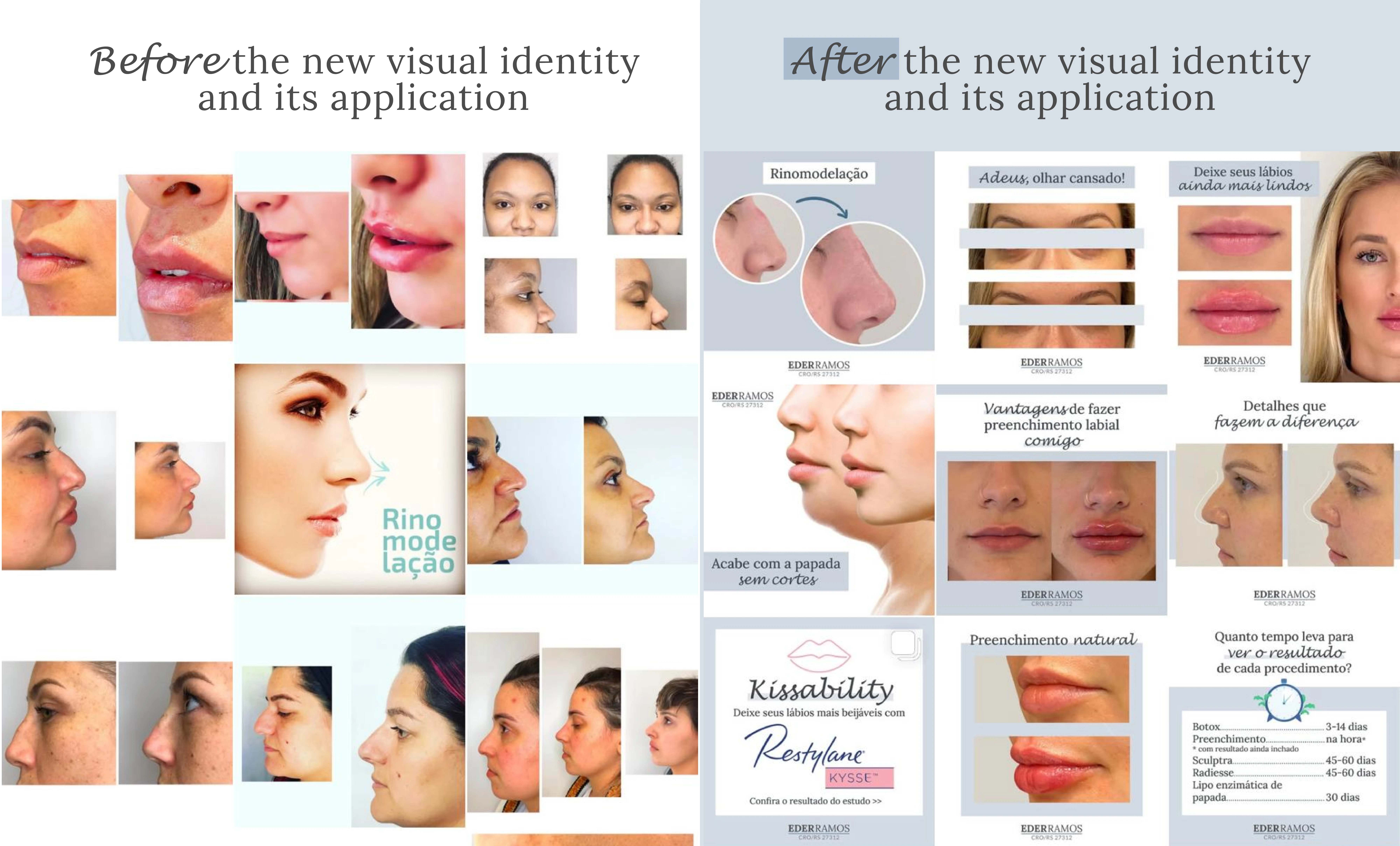 Social Media | Before & After