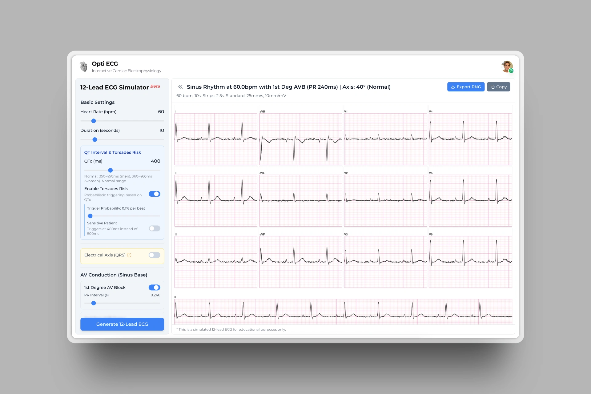 12 Lead ECG Simulator