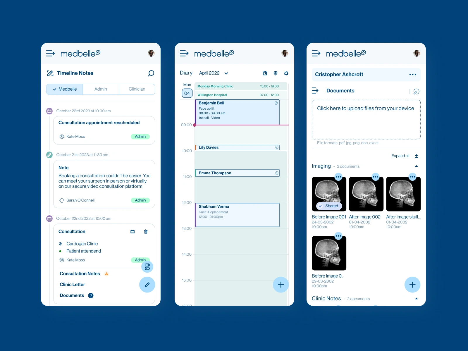 Some Screens for Mobile