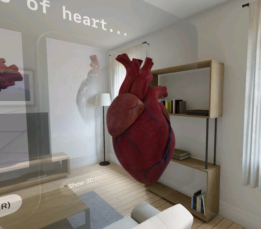 AR model of heart