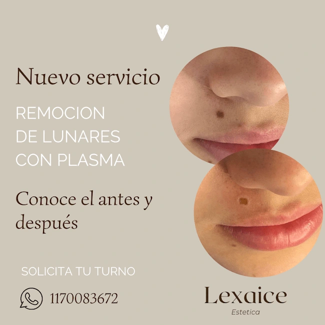 Service Flyer