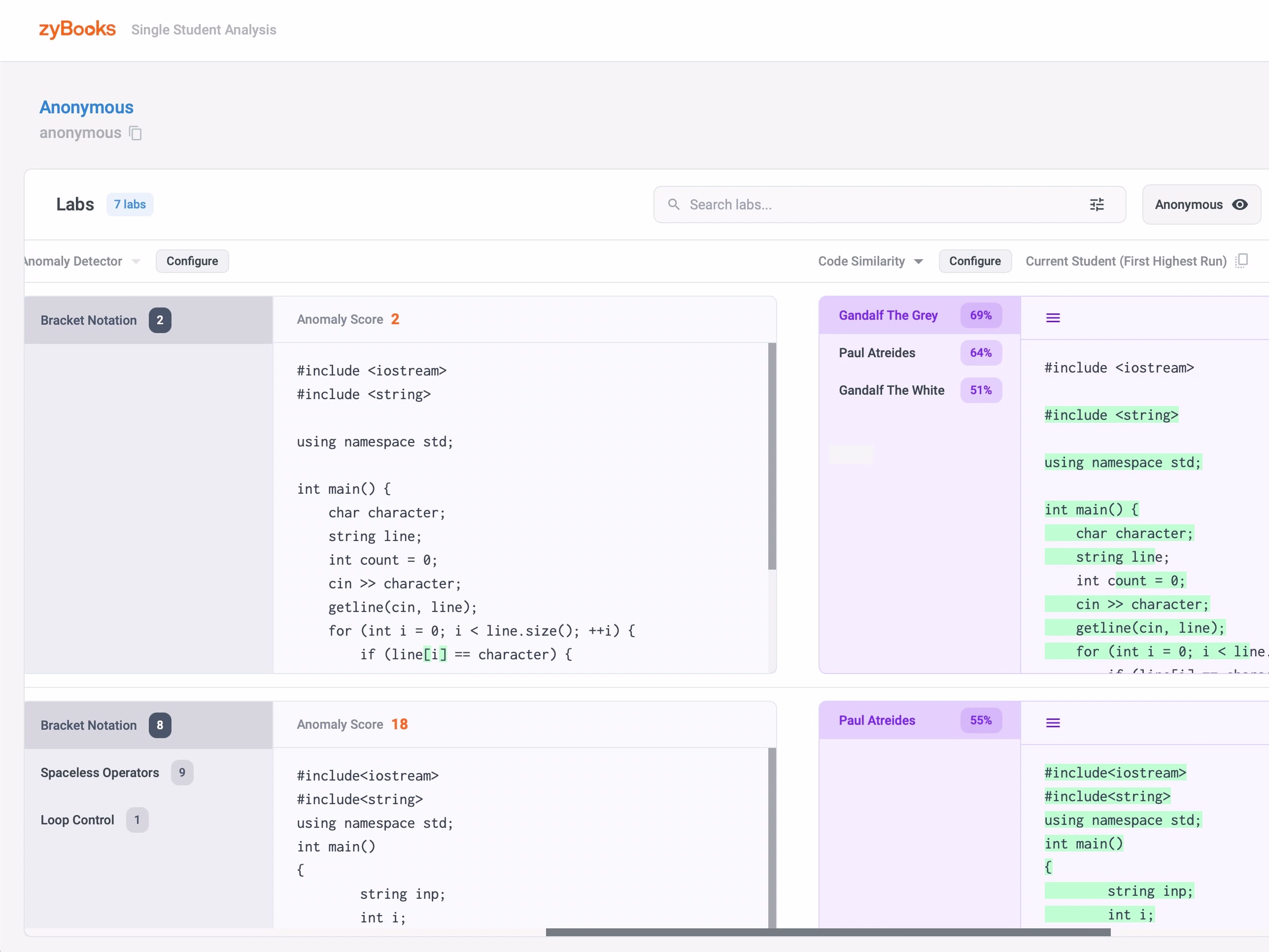 Placeholder project card media