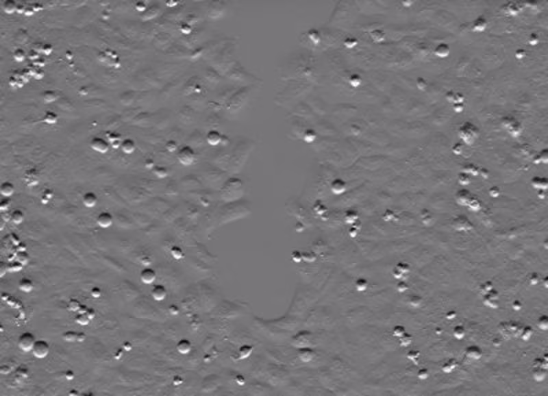 Cover image for Image Processing and Analysis of the Scratch Assay