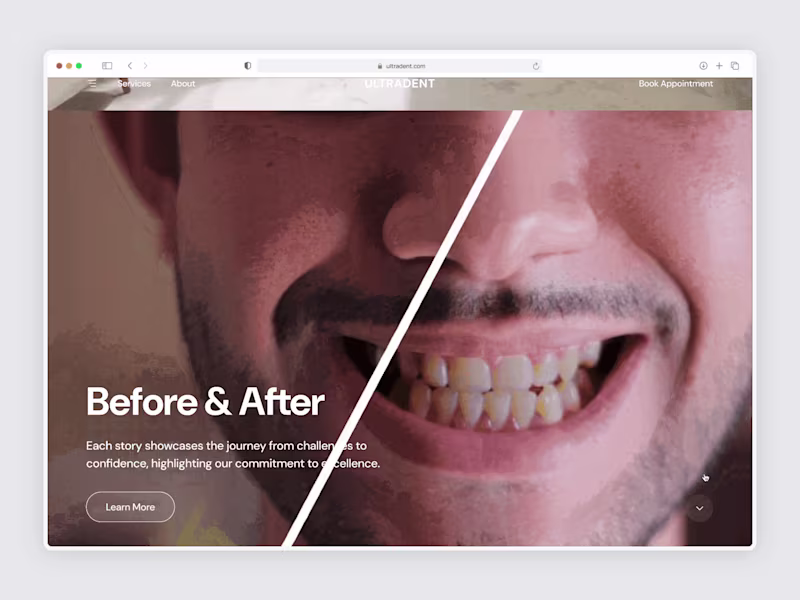 Cover image for UltraDent ◦ Dental Clinic Website