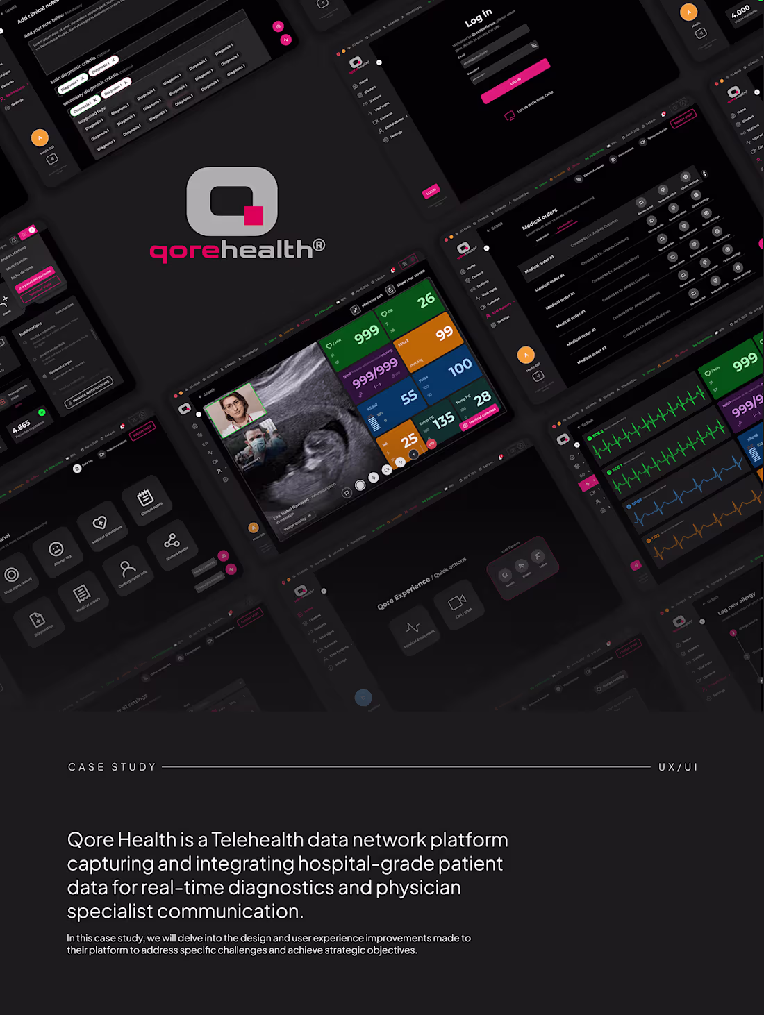 Cover image for UI/UX Case Study - Qore Health