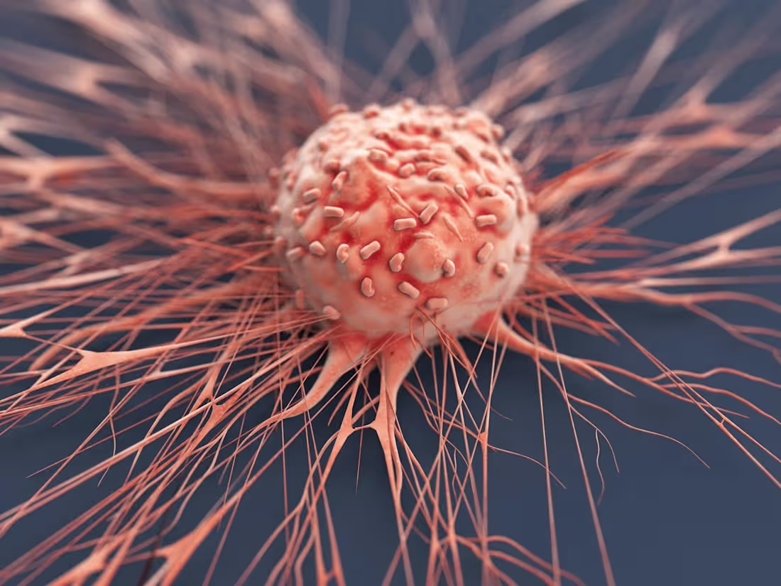 Cover image for "Cancer is a word, not a sentence."
