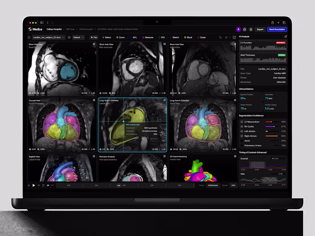 Cover image for Medica is an AI-powered cardiac