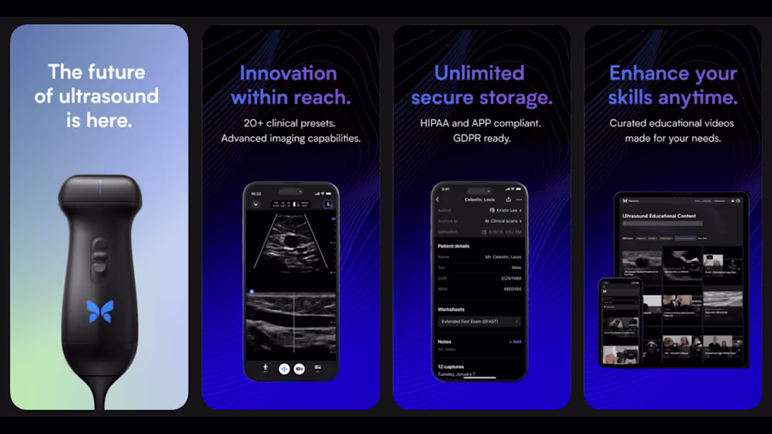 Cover image for I develop end-to-end features for