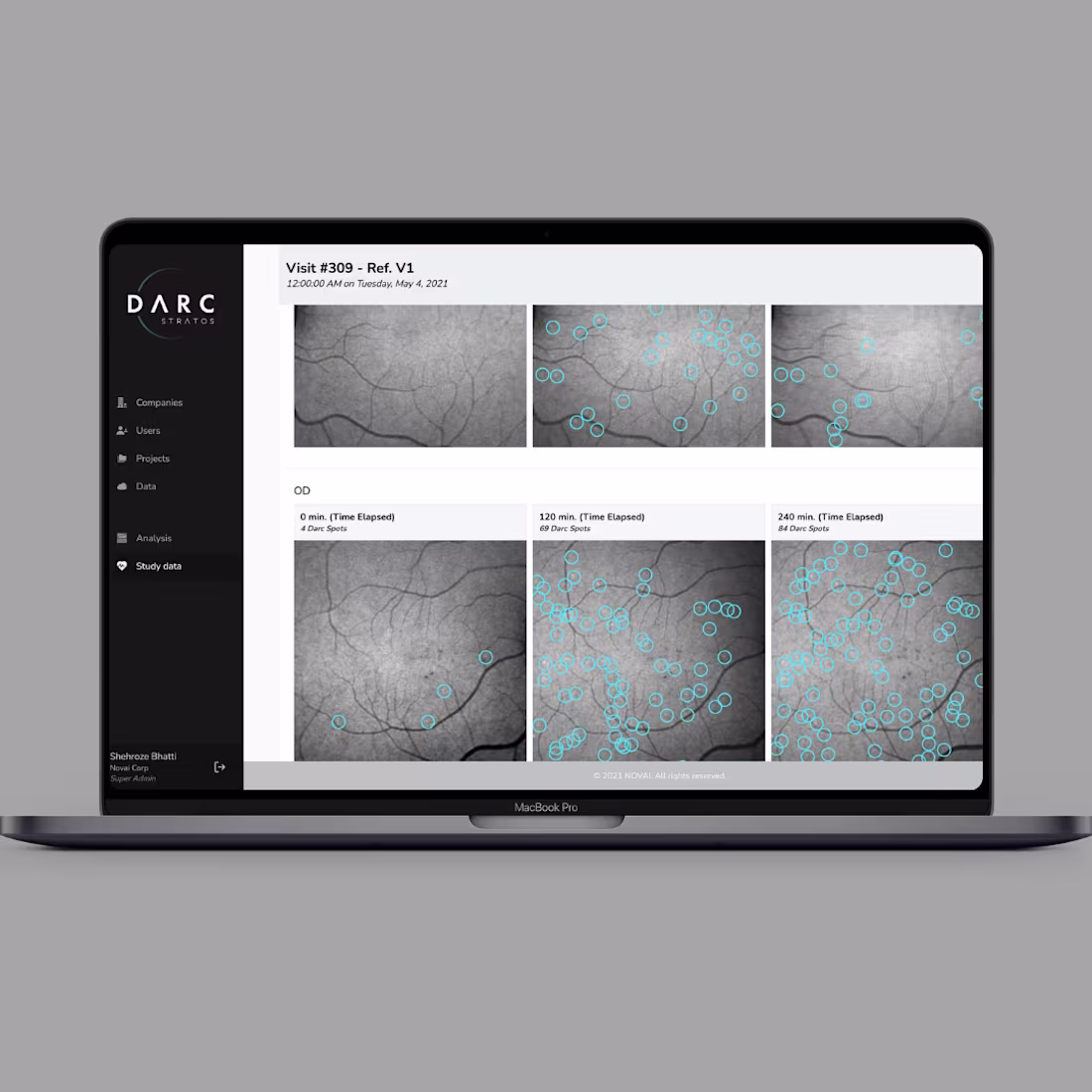 Cover image for Novai AI Diagnostic & Imaging Platform