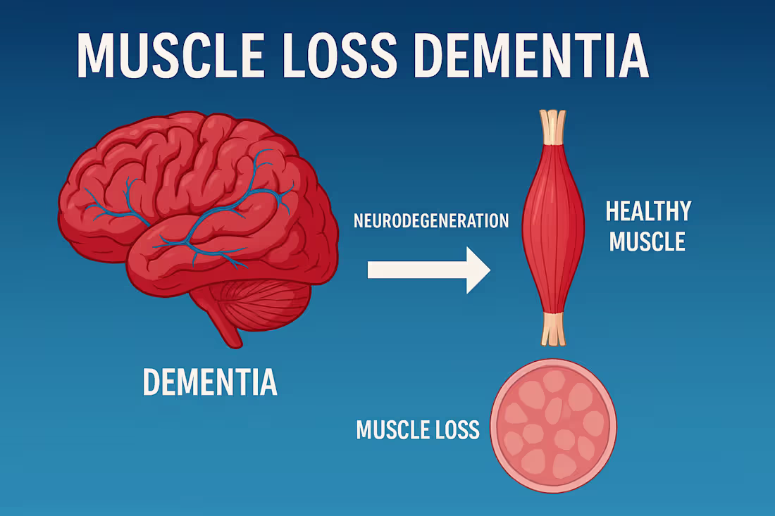 Cover image for Muscle Loss Dementia: Understanding and Prevention