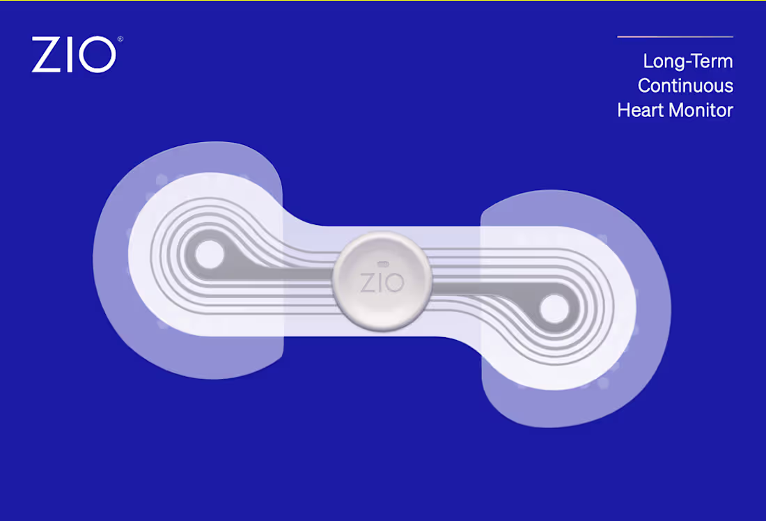 Cover image for Revolutionizing Packaging Design for iRhythm