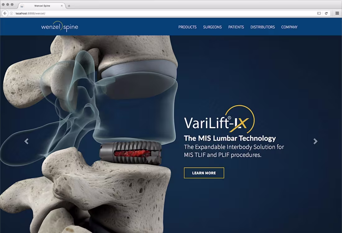 Cover image for Wenzel Spine