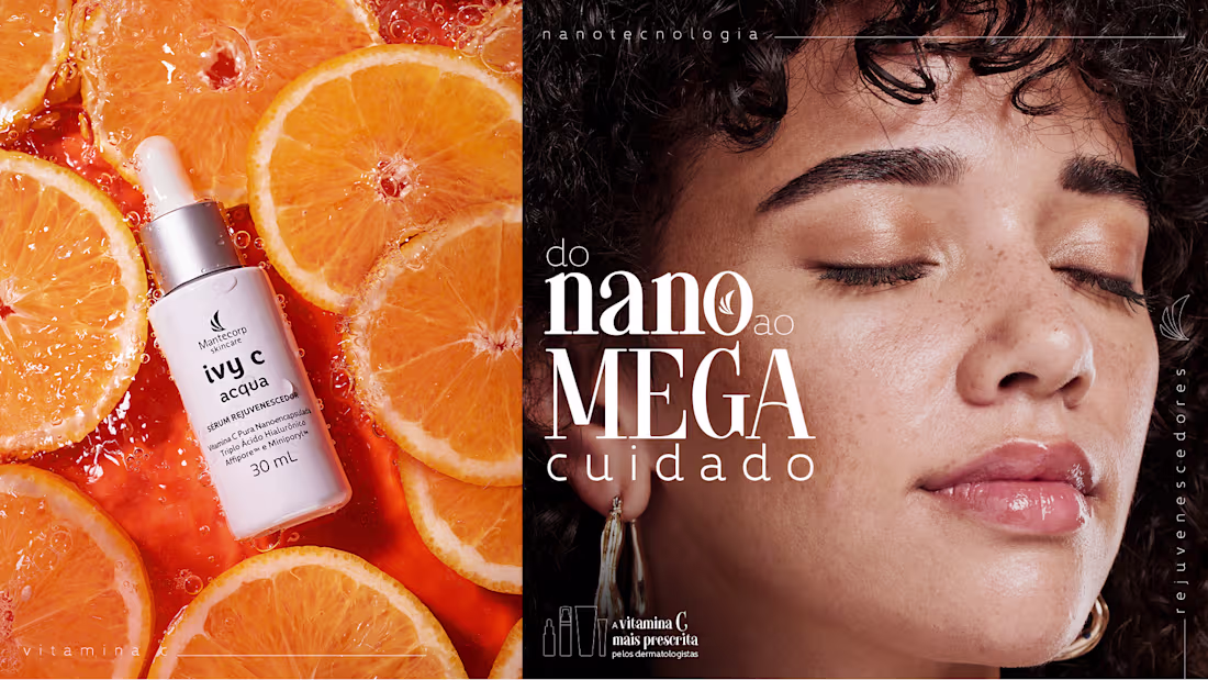 Cover image for Mantecorp | Ivy C
Ivy C