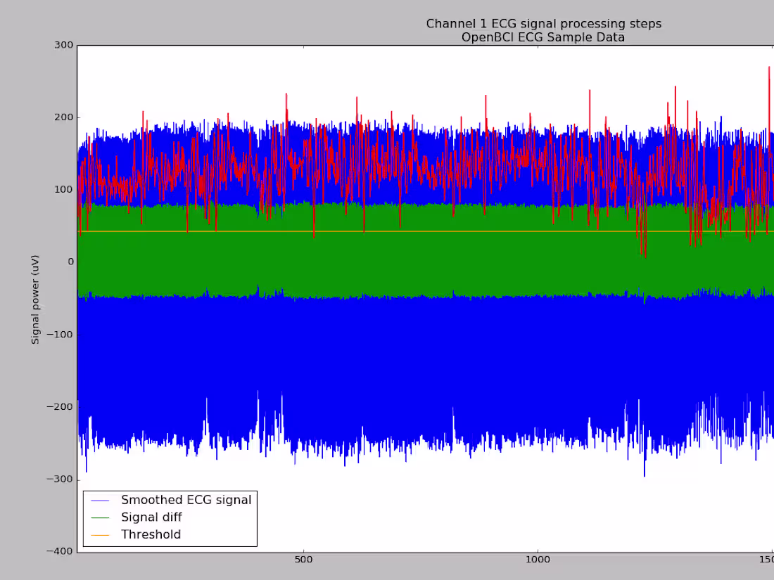 Cover image for Outlier Detection and Analysis using BMI and HRV Data