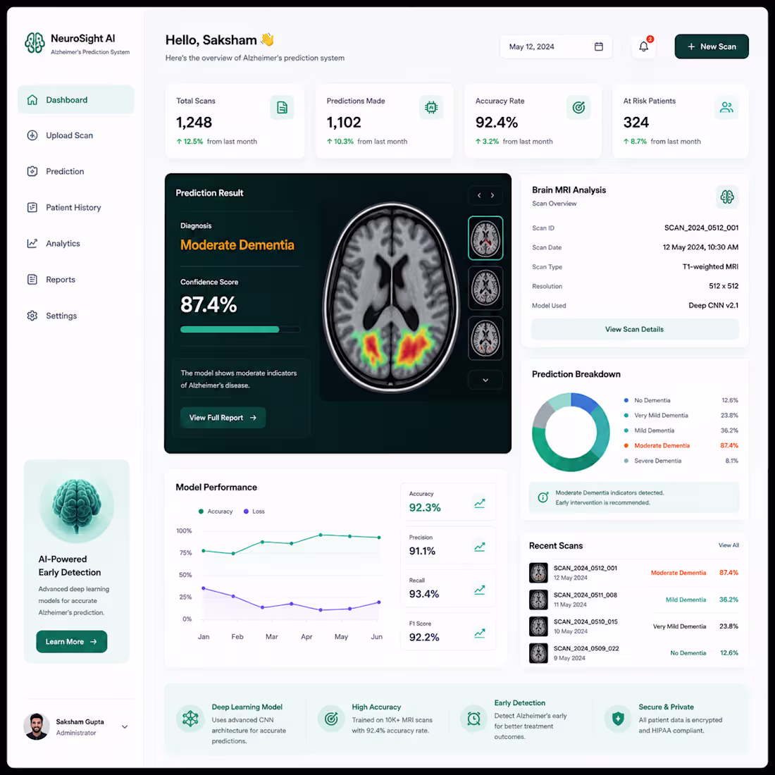 Cover image for Developed an AI-driven Alzheimer’s disease