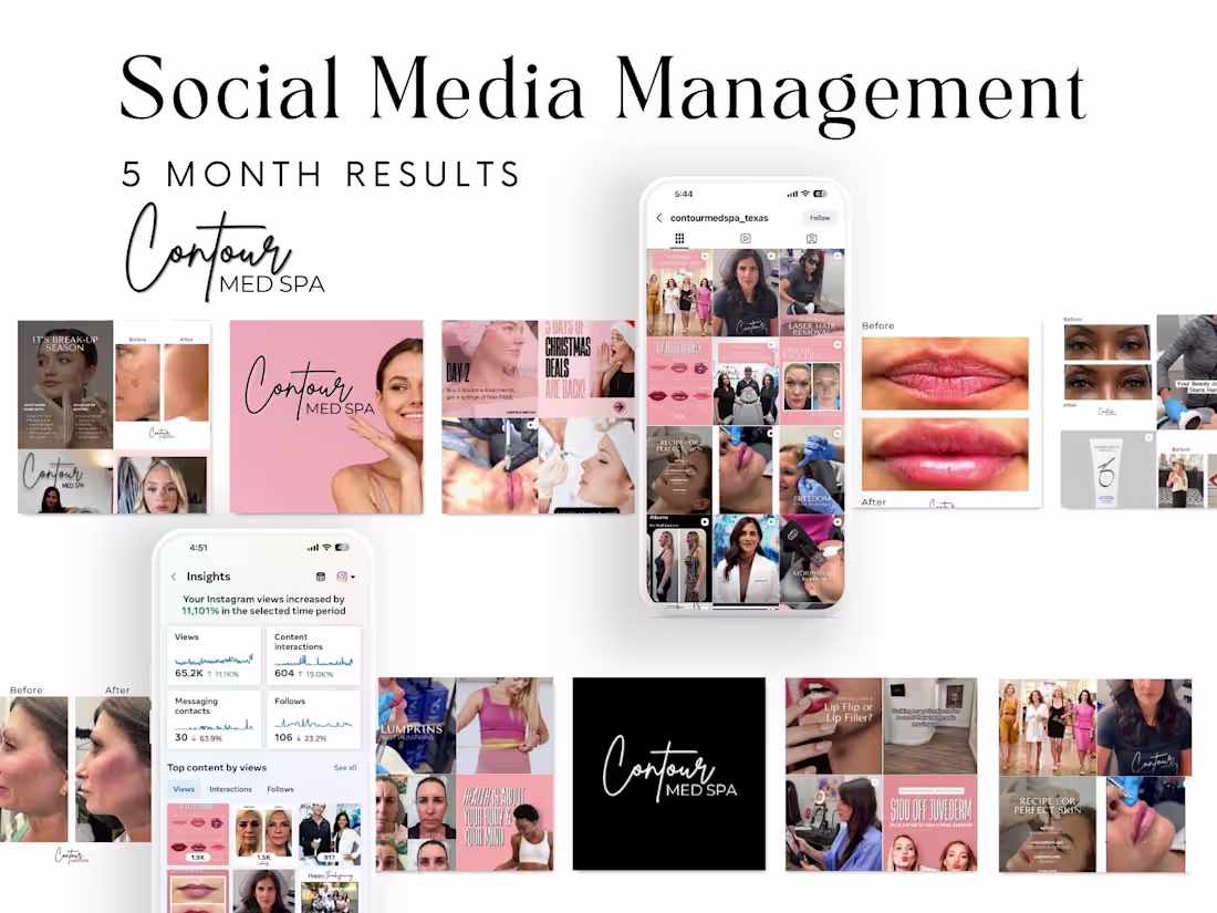 Cover image for End-to-End Instagram Management for a Medspa