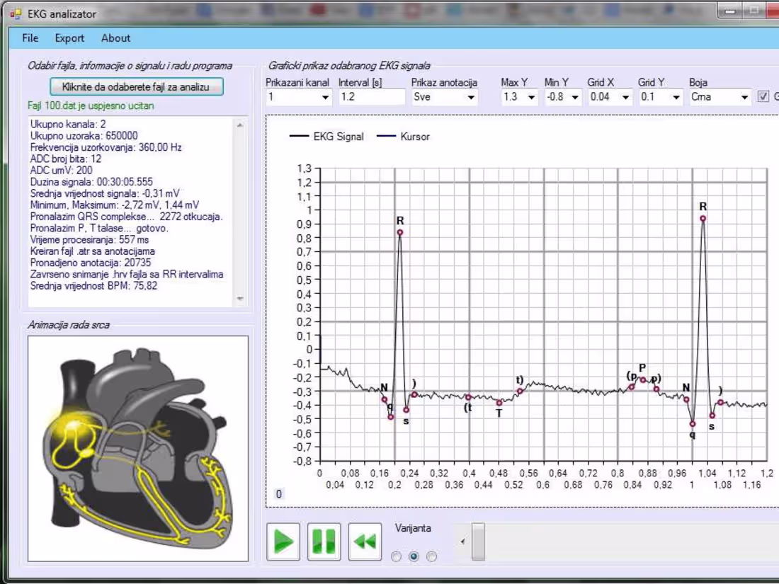 Cover image for EKG analyzer