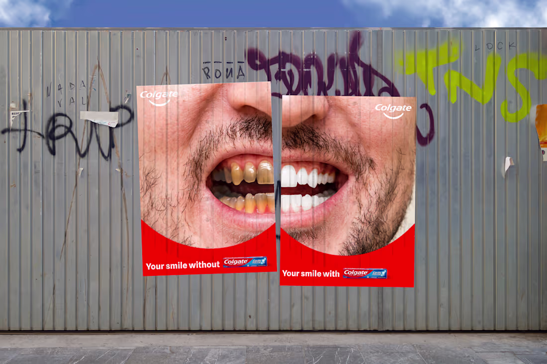 Cover image for Advertising Campaign for Colgate USA