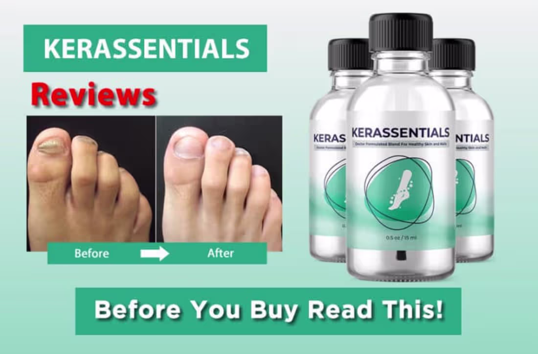 Cover image for Kerassentials Review 2026: Clear Nail Fungus