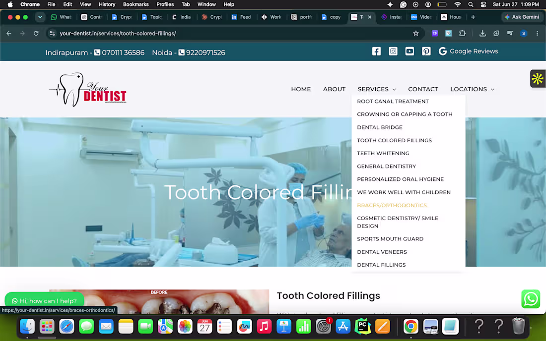 Cover image for wrote seo keywords for dental