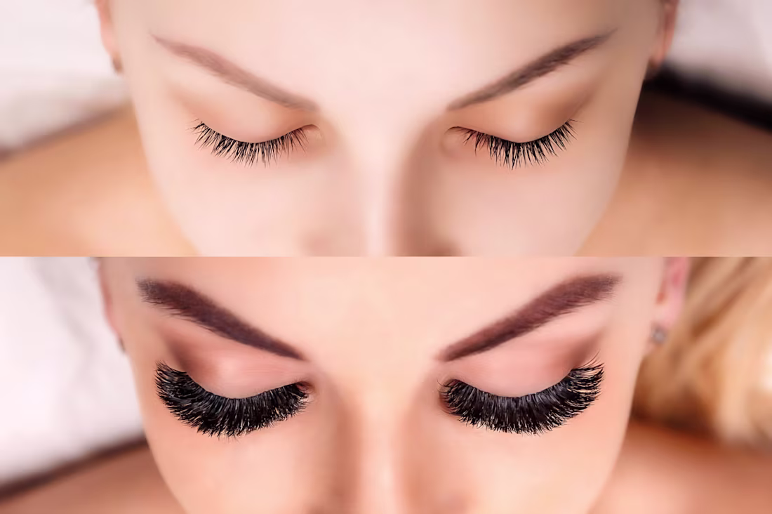 Cover image for This before-and-after visual demonstrates my