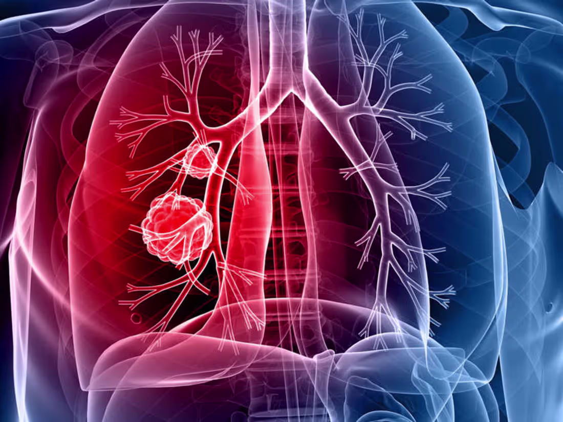 Cover image for samrat0033/Lung_Cancer_Prediction