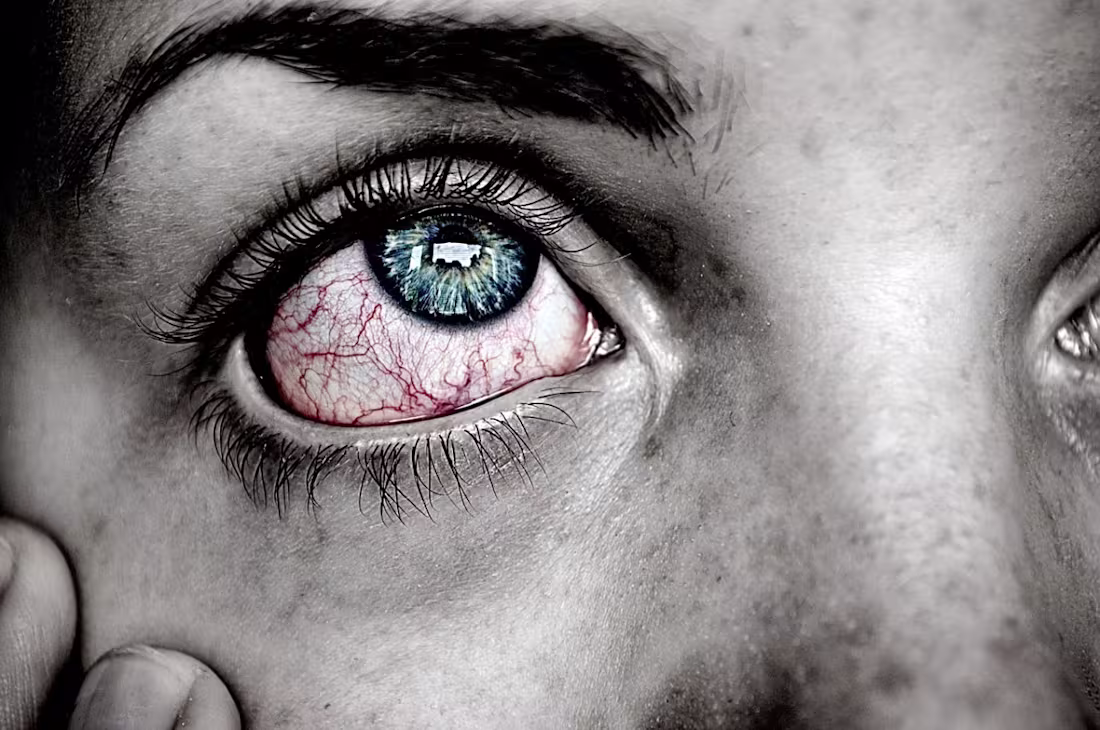 Cover image for How to Cope With Conjunctivitis (Apollo)
