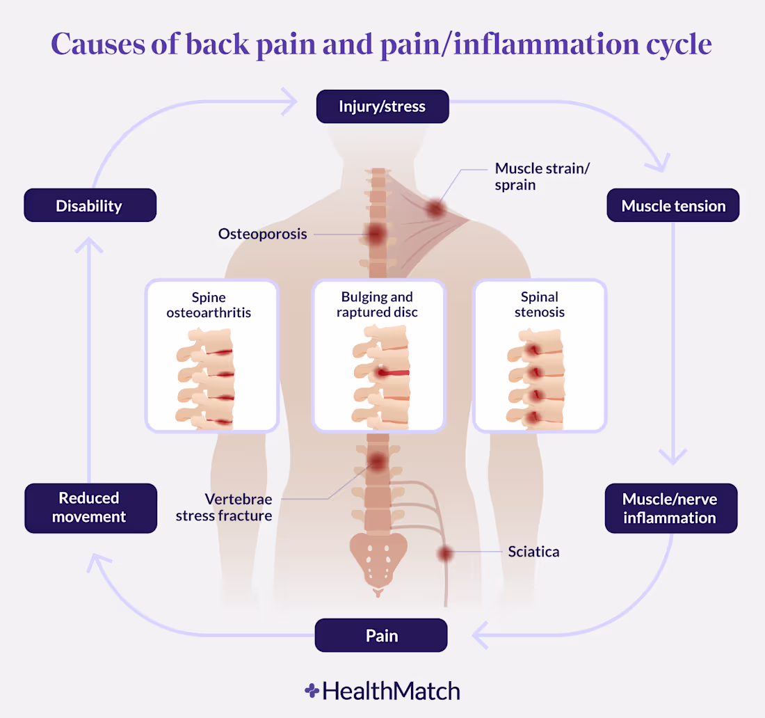 Cover image for Writing and Researching: When Painkillers Make Back Pain Worse