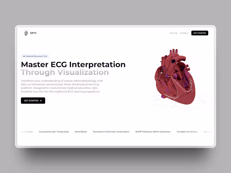 Cover image for Opti - 3D ECG Visualization Education Tool
