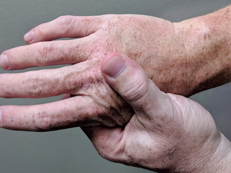Cover image for Technical Editing: Medical Document