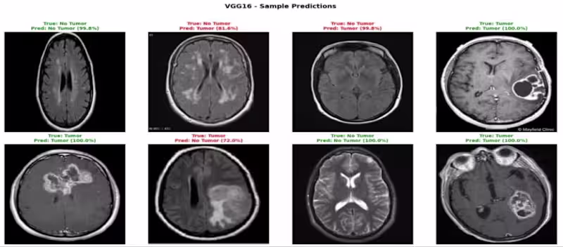Cover image for Automated Brain Tumor Detection (VGG16)