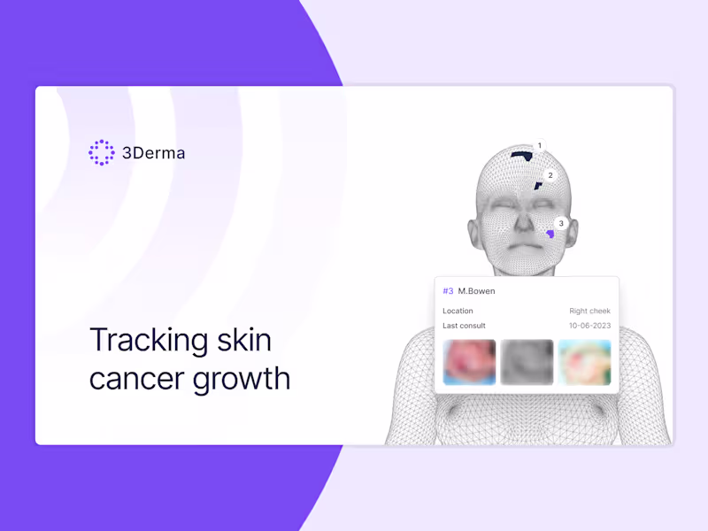Cover image for Analyze skin lesions to help detect early signs of skin cancer