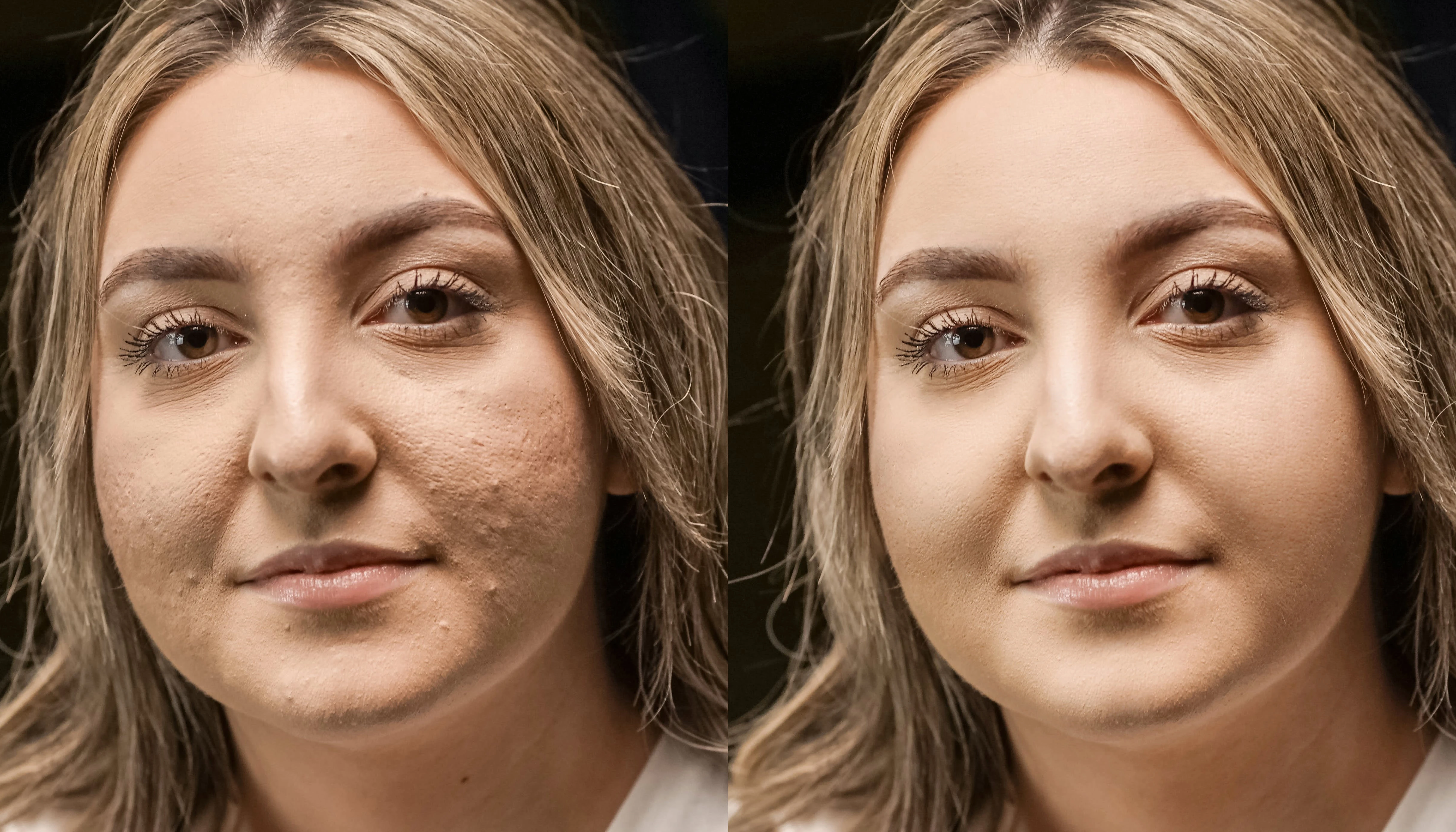 Skin retouch Before and After