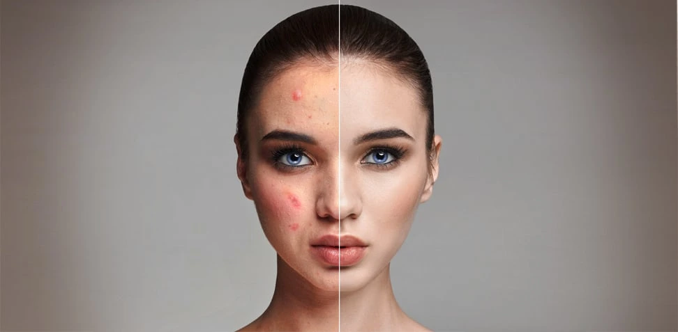 Image retouching before & after