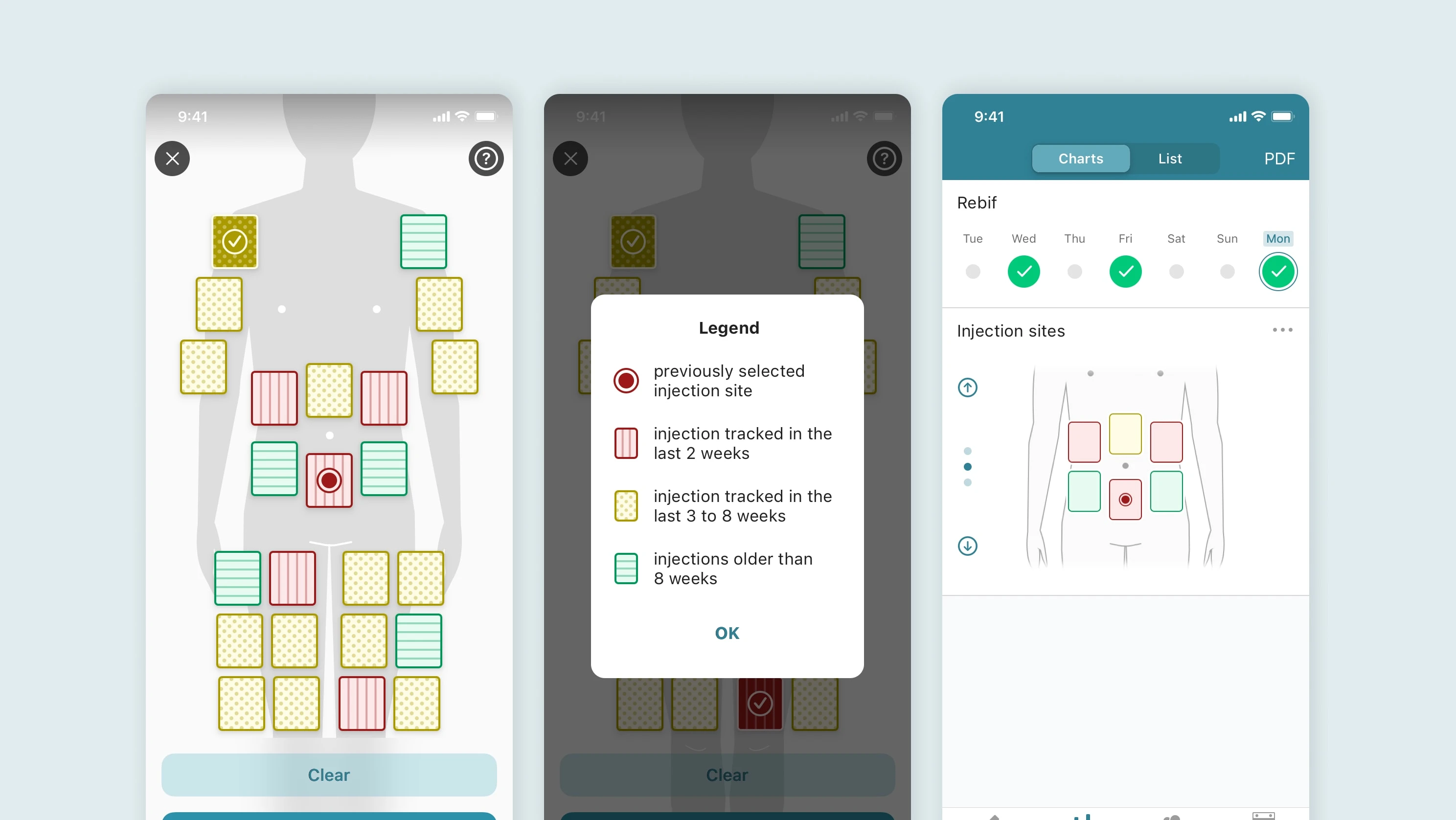 Injection site tracking feature on iOS