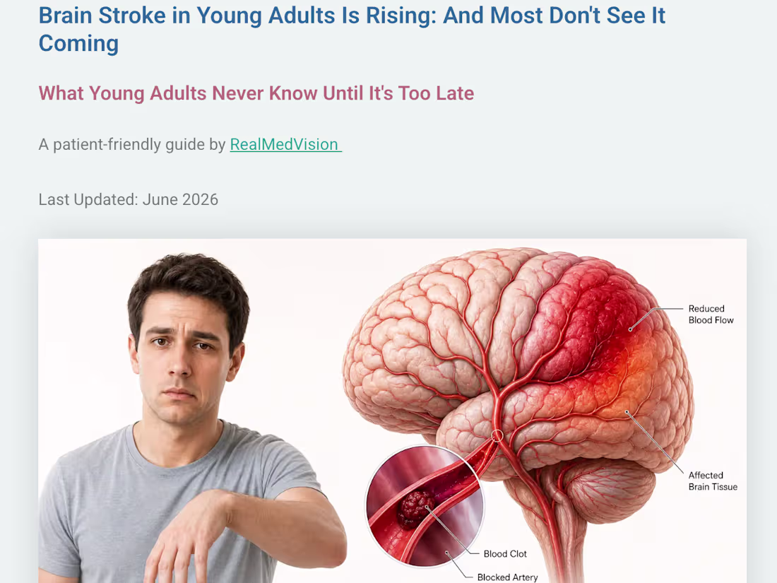 Cover image for Most people think stroke only