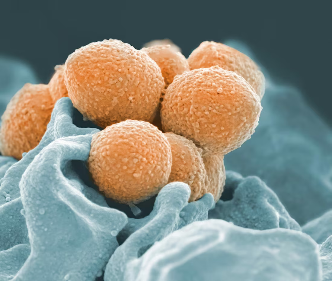 Cover image for Understanding Sepsis Dr. Abbas Okanga