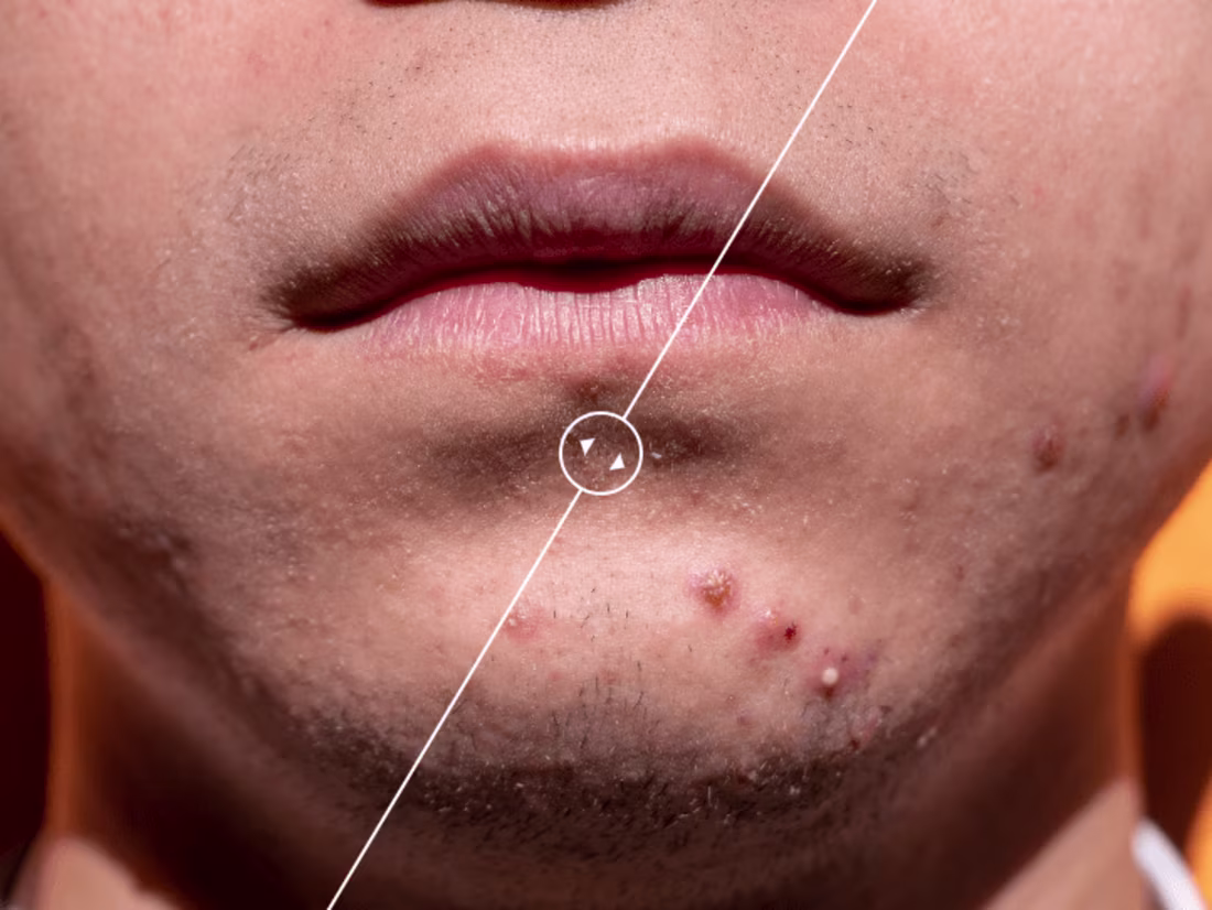 Cover image for Blemish Removal (Sample)