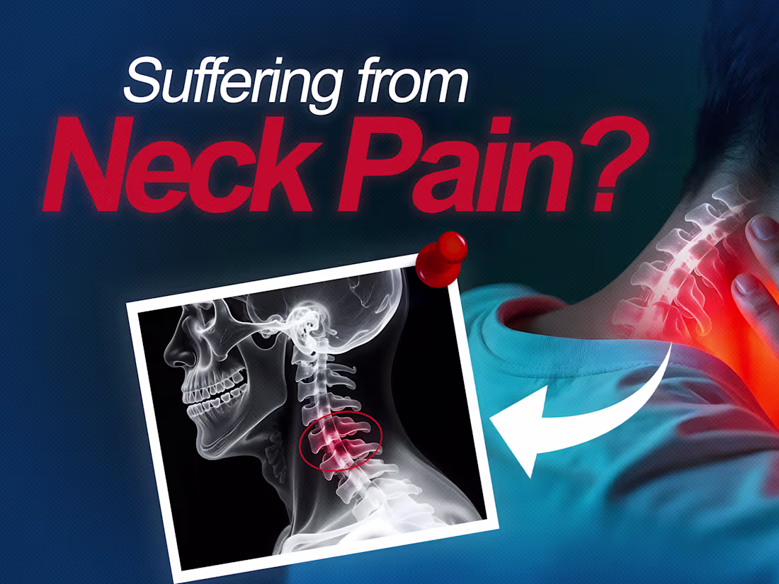 Cover image for ACDF Surgery Explaination