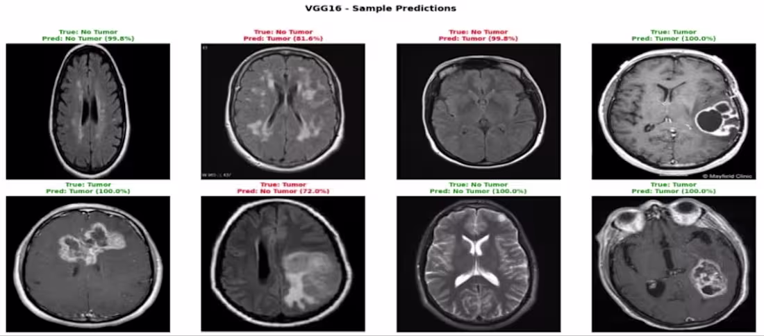 Cover image for Automated Brain Tumor Detection (VGG16)