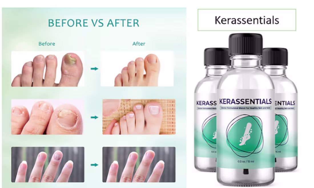 Cover image for Kerassentials - The Perfect Solution To Every Fungal Infection