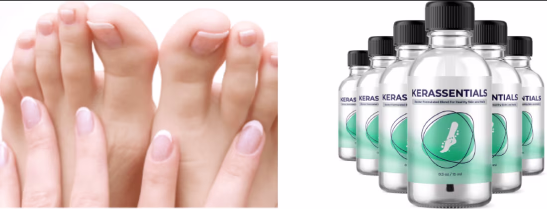 Cover image for Kerassentials – [Is It Scam or Legit?] Should You Buy?