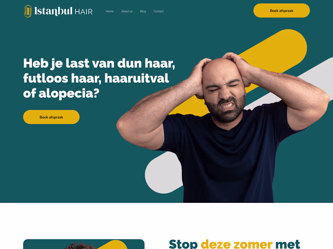Cover image for Hair Transplant Landing Page