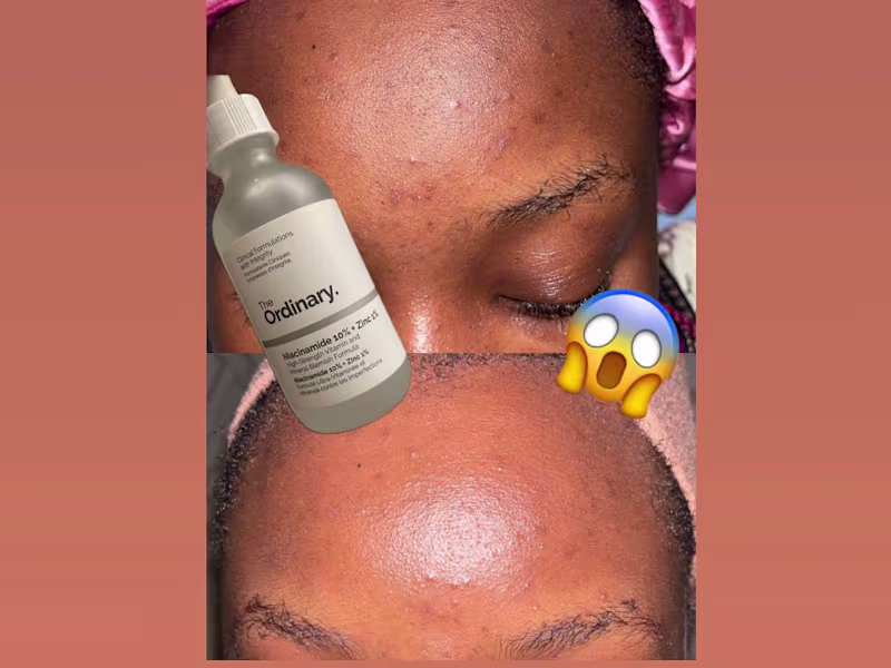 Cover image for OMG! The Best SERUM Ever!