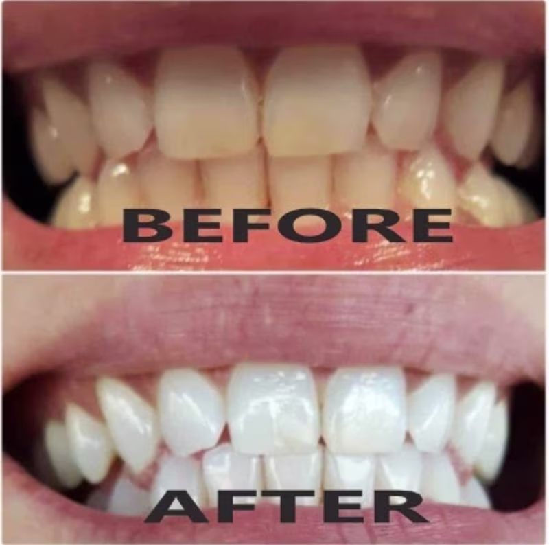 Cover image for PREMIUM ORAL CARE ON A BUDGET